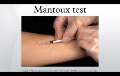sanità. TUBERCOLOSI, TEST MANTOUX A STUDENTI E DOCENTI sanità. TUBERCOLOSI, TEST MANTOUX A STUDENTI E DOCENTI