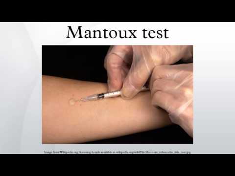 sanità. TUBERCOLOSI, TEST MANTOUX A STUDENTI E DOCENTI sanità. TUBERCOLOSI, TEST MANTOUX A STUDENTI E DOCENTI