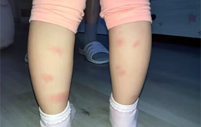 quarrata. ZANZARE, MONTA LA PROTESTA: «BAMBINI PIENI DI PUNTURE, NON SI RIESCE PIÙ A STARE ALL’APERTO» quarrata. ZANZARE, MONTA LA PROTESTA: «BAMBINI PIENI DI PUNTURE, NON SI RIESCE PIÙ A STARE ALL’APERTO»